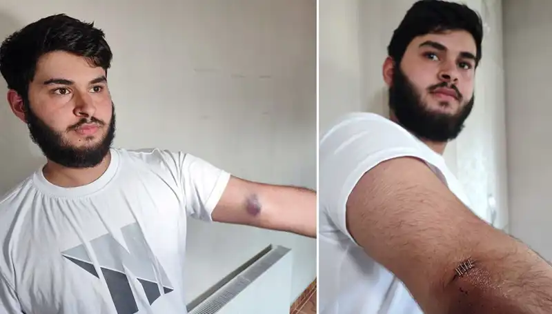 Bahçeye Kaçan Top, Mahallede Gergin Anlar Yarattı: Kamyonetle Gelen Conolar