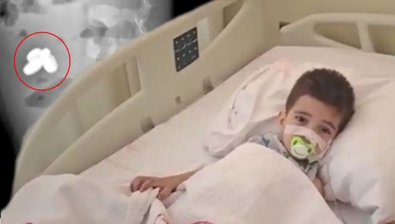 Mıknatıs ve Pil Yutan Çocuğun Karın Ağrısı Korkutucu Bir Sonuçla Bitti
