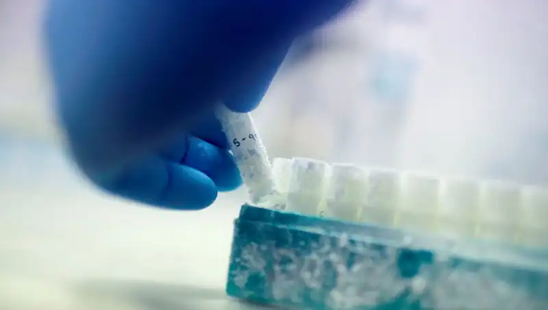 Tıbbi Skandal: 85 Sperm Donörü Binyıllarca Baba Oldu