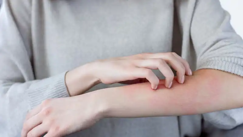 Cilt Kanserinin Belirtileri: Dermatologdan Şaşırtan İpuçları
