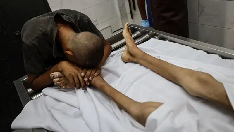 Gazze'de Savaşın Innocenti: Açlık Sebebiyle Bir Çocuk Daha Hayatını Kaybetti